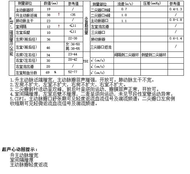 343537df14988cd787a5955e0933ddd4_compress