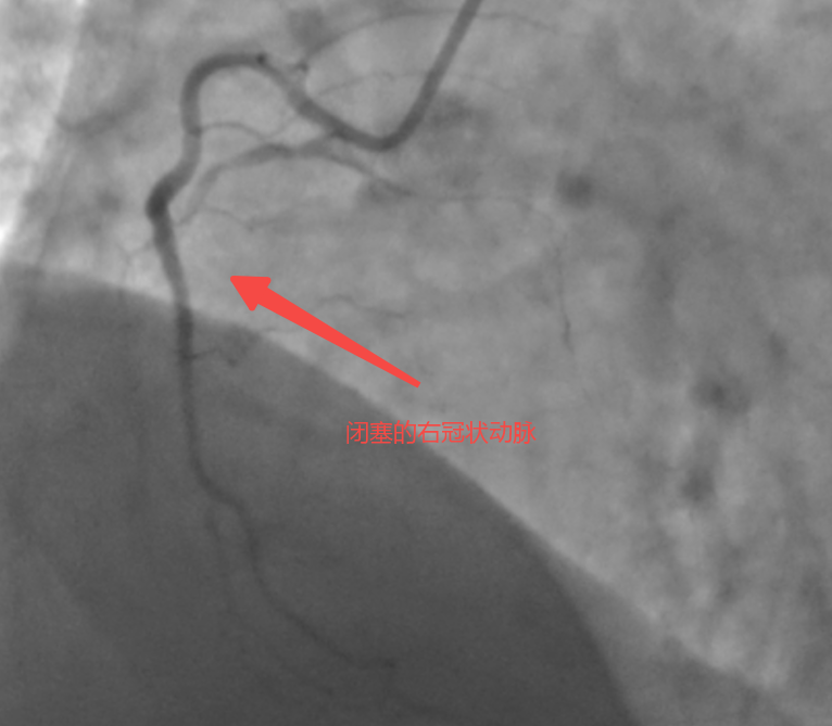 20250611-153758 20250611-153758