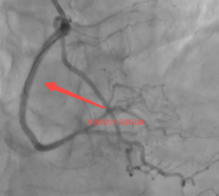 20250611-153803 20250611-153803