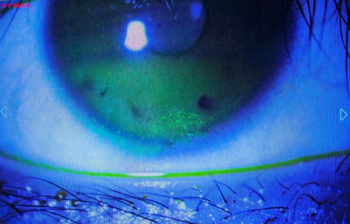 fa48b71fc55141fea8c806ec379309c1~tplv-tt-origin-web_gif